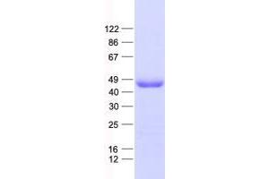 WDR31 Protein (His tag)