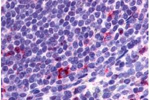 Anti-CCR2 antibody  ABIN1048390 IHC staining of human spleen, lymphocytes. (CCR2 抗体  (N-Term))