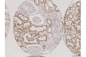 Immunohistochemistry (IHC) image for anti-Aquaporin 2 (Collecting Duct) (AQP2) (AA 171-271) antibody (ABIN707576)