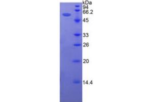 SDS-PAGE analysis of Human Intercellular Adhesion Molecule 5 Protein. (ICAM5 蛋白)