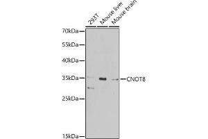 Western blot analysis of extracts of various cell lines, using CNOT8 antibody (ABIN6127644, ABIN6138786, ABIN6138788 and ABIN6224080) at 1:1000 dilution. (CNOT8 抗体  (AA 1-292))