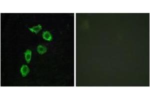 Immunofluorescence analysis of HuvEc cells, using GPR123 Antibody. (GPR123 抗体  (AA 201-250))