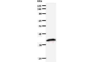 Western Blotting (WB) image for anti-Nudix (Nucleoside Diphosphate Linked Moiety X)-Type Motif 21 (NUDT21) antibody (ABIN933117)