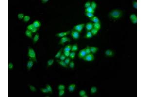 Immunofluorescence staining of PC-3 cells with ABIN7163969 at 1:100, counter-stained with DAPI. (KCNC3 抗体  (AA 638-745))