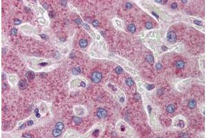 Human Liver: Formalin-Fixed, Paraffin-Embedded (FFPE) (ATF5 抗体  (AA 101-150))
