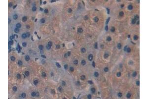 Immunohistochemistry (IHC) image for anti-Interleukin 35 (IL35) (AA 23-219) antibody (ABIN7438589)