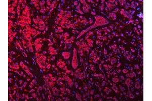 IF analysis of SEPTIN9 using anti-SEPTIN9 antibody (ABIN7600104). (Septin 9 抗体  (AA 15-282))