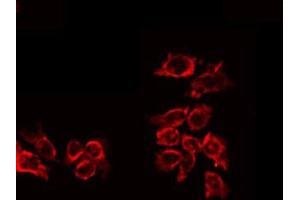 ABIN6267644 staining HuvEc by IF/ICC. (IL-10RA 抗体  (pTyr496))