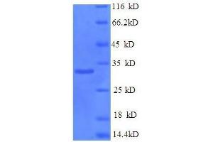 SDS-PAGE (SDS) image for Prohibitin (PHB) (AA 1-272), (full length) protein (His tag) (ABIN5710089) (Prohibitin Protein (PHB) (AA 1-272, full length) (His tag))