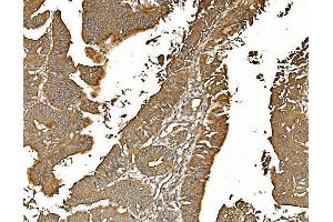 IHC analysis of PP2A-alpha/PPP2CA using anti-PP2A-alpha/PPP2CA antibody (ABIN7599250).