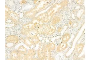 ABIN6264415 and ABIN6278511 at 1/100 staining human normal kidney tissue by IHC-P. (SLC26A5 抗体  (Internal Region))