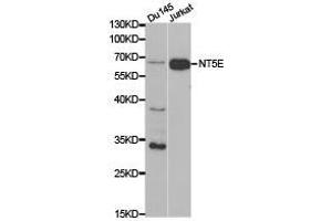 Western Blotting (WB) image for anti-5'-Nucleotidase, Ecto (CD73) (NT5E) antibody (ABIN1873965) (CD73 抗体)