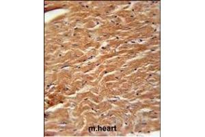 Immunohistochemistry (Paraffin-embedded Sections) (IHC (p)) image for anti-Coatomer Protein Complex, Subunit zeta 2 (COPZ2) (AA 156-184), (C-Term) antibody (ABIN651368)