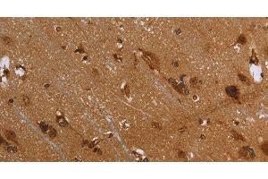 Immunohistochemistry of paraffin-embedded Human brain using FLNA Polyclonal Antibody at dilution of 1:40 (Filamin A 抗体)