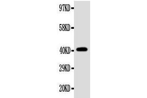 Anti-EDA antibody, Western blotting WB: SW620 Cell Lysate (Ectodysplasin A 抗体  (Middle Region))