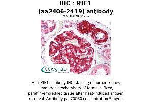 Image no. 1 for anti-RAP1 Interacting Factor Homolog (RIF1) (AA 2406-2419) antibody (ABIN1738875) (RIF1 抗体  (AA 2406-2419))