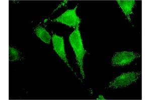 Immunofluorescence of monoclonal antibody to TRIM17 on HeLa cell. (TRIM17 / RNF16 抗体  (AA 75-184))