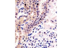 (ABIN6243947 and ABIN6578467) staining PHC3 in human kidney tissue sections by Immunohistochemistry (IHC-P - paraformaldehyde-fixed, paraffin-embedded sections). (PHC3 抗体  (AA 819-850))