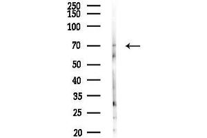 anti-Interleukin 17 Receptor C (IL17RC) (C-Term) antibody