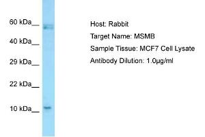 Host: RabbitTarget Name: MSMBAntibody Dilution: 1. (MSMB 抗体  (C-Term))