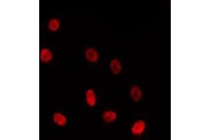 ABIN6275723 staining HepG2 by IF/ICC. (ZNF691 抗体  (Internal Region))