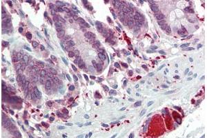 Human Small Intestine (formalin-fixed, paraffin-embedded) stained with TLR7 antibody ABIN334260 at 5 ug/ml followed by biotinylated goat anti-rabbit IgG secondary antibody ABIN481713, alkaline phosphatase-streptavidin and chromogen. (TLR7 抗体  (AA 706-728))