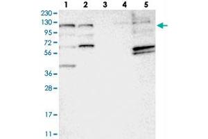 Western blot analysis of Lane 1: RT-4, Lane 2: U-251 MG, Lane 3: Human Plasma, Lane 4: Liver, Lane 5: Tonsil with C10orf118 polyclonal antibody  at 1:250-1:500 dilution. (C10orf118 抗体)