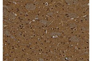 anti-B-Cell CLL/lymphoma 11A (Zinc Finger Protein) (BCL11A) (Internal Region) antibody