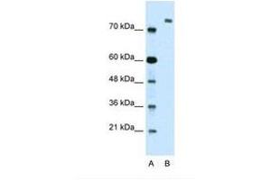 Image no. 1 for anti-Zinc Finger Protein 261 (ZMYM3) (AA 51-100) antibody (ABIN324361) (ZMYM3 抗体  (AA 51-100))