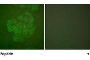 Immunofluorescence analysis of A-549 cells, using NR3C1 polyclonal antibody . (Glucocorticoid Receptor 抗体)