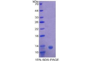 SDS-PAGE (SDS) image for Complement Component C4b (C4b) (AA 680-756) protein (His tag) (ABIN2124458)