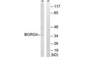 Western blot analysis of extracts from Jurkat cells, using BORG4 Antibody.
