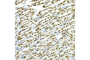 Immunohistochemistry of paraffin-embedded rat stomach using T Rabbit mAb (ABIN7270715) at dilution of 1:25 (40x lens).