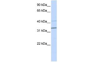 WB Suggested Anti-PYHIN1 Antibody Titration:  0.