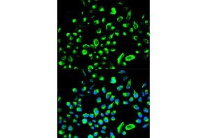 Immunofluorescence analysis of HeLa cells using YWHAQ antibody. (14-3-3 theta 抗体  (AA 1-245))