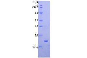 SDS-PAGE of Protein Standard from the Kit (Highly purified E. (APOA1 ELISA 试剂盒)