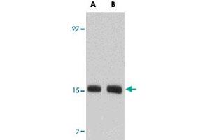 Western blot analysis of SKA2 in NIH/3T3 cell lysate with SKA2 polyclonal antibody  at (A) 0. (FAM33A 抗体  (N-Term))