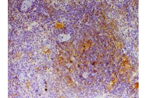 Immunohistochemistry (IHC) image for anti-CD40 Ligand (CD40LG) (AA 107-260) antibody (ABIN5692813)