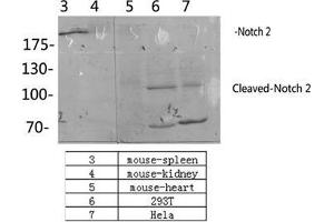 Western Blot (WB) analysis: Please contact us for more details. (NOTCH2 抗体  (Asp1733, cleaved))