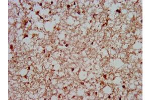 IHC image of ABIN7155794 diluted at 1:400 and staining in paraffin-embedded human brain tissue performed on a Leica BondTM system. (MKX 抗体  (AA 157-305))