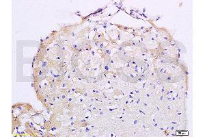 Angiotensin II Type 2 Receptor 抗体