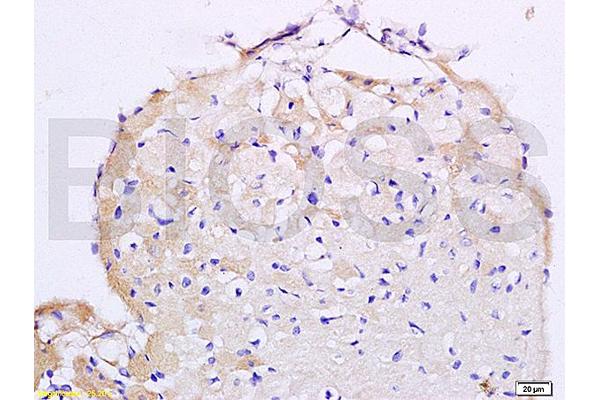 Angiotensin II Type 2 Receptor 抗体