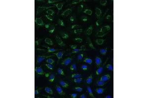 Immunofluorescence (IF) image for anti-Electron-Transfer-Flavoprotein, beta Polypeptide (ETFB) (AA 80-230) antibody (ABIN7266916)
