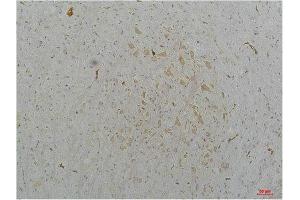 Immunohistochemistry (IHC) analysis of paraffin-embedded Mouse Brain Tissue using Cav2. (CACNA1B 抗体)