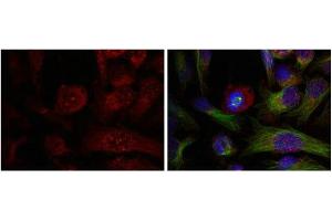 Immunofluorescence (IF) image for anti-V-Akt Murine Thymoma Viral Oncogene Homolog 1 (AKT1) (pThr308) antibody (ABIN7138831)