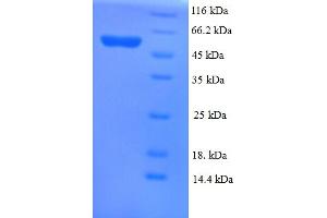 SDS-PAGE (SDS) image for Alanine Aminotransferase (ALT) (AA 2-496) protein (His tag) (ABIN5709611)