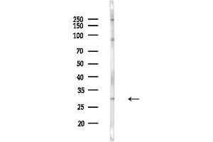 anti-RAB5B, Member RAS Oncogene Family (RAB5B) (C-Term) antibody