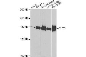 Western blot analysis of extracts of various cell lines, using CLTC antibody. (Clathrin Heavy Chain (CLTC) 抗体)