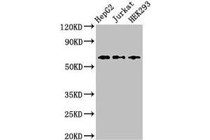Western Blot Positive WB detected in: HepG2 whole cell lysate, Jurkat whole cell lysate, HEK293 whole cell lysate All lanes: CD96 antibody at 2. (CD96 抗体  (AA 306-395))