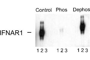 Western blots of immunoprecipitates from HEK 293 cells transfected with 1. (IFNAR1 抗体  (pSer535, pSer539))